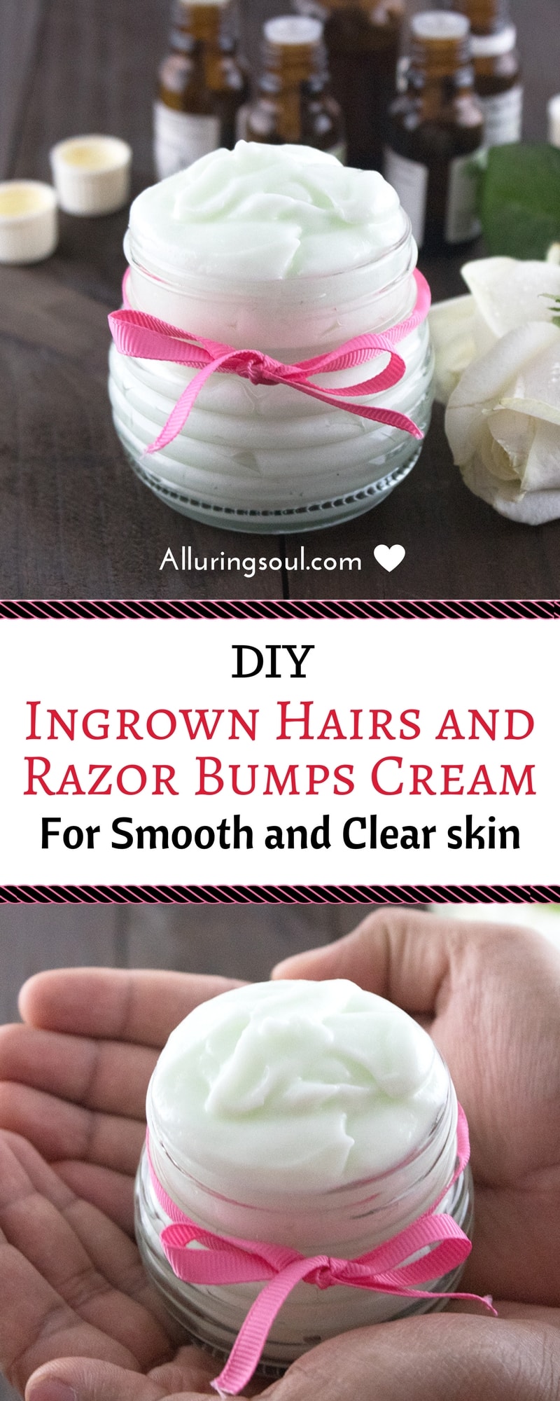 Diy Ingrown Hair Cream To Get Rid Of Nasty Red Bumps