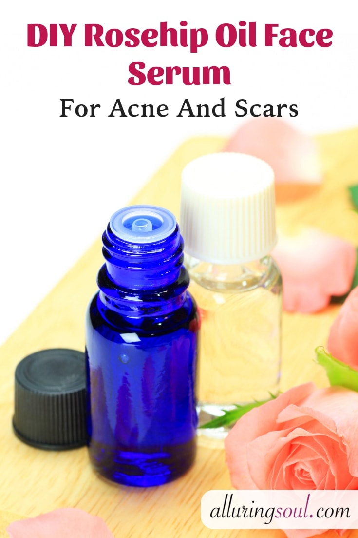 rosehip oil for acne