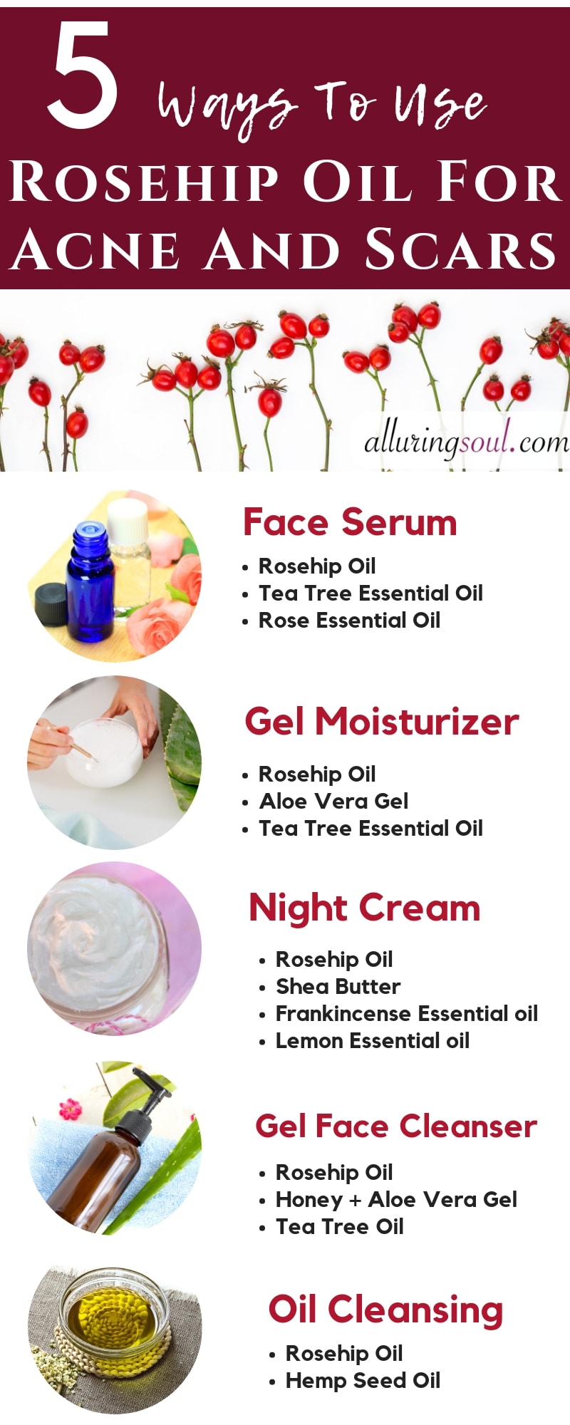 rosehip oil for acne