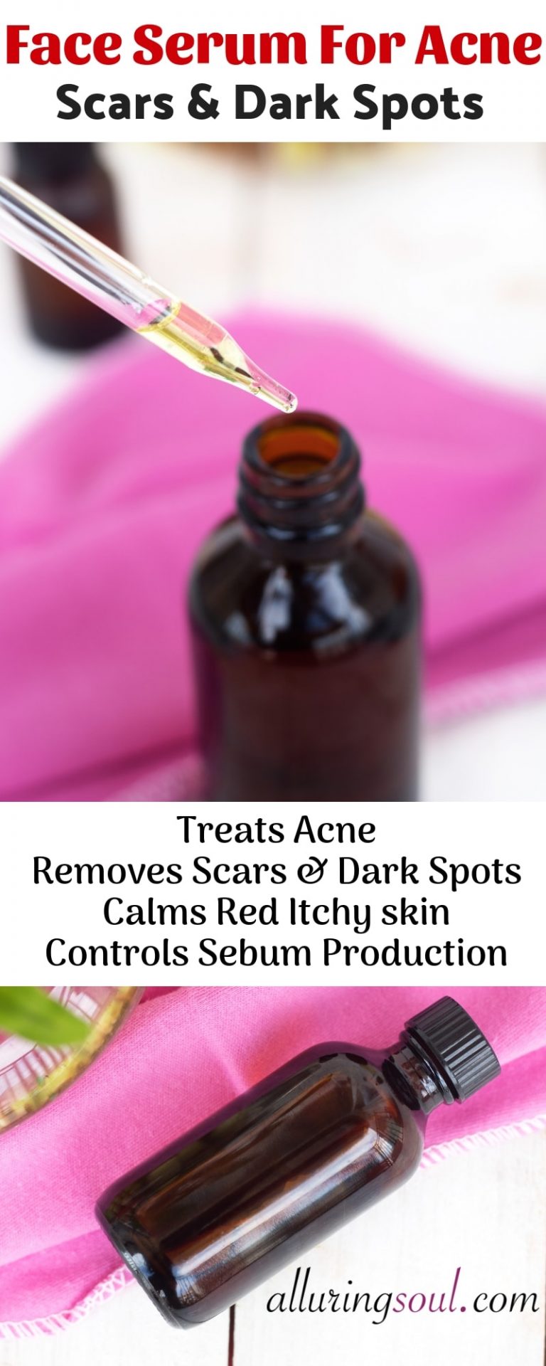 DIY Face Serum For Acne, Scars & Dark Spots