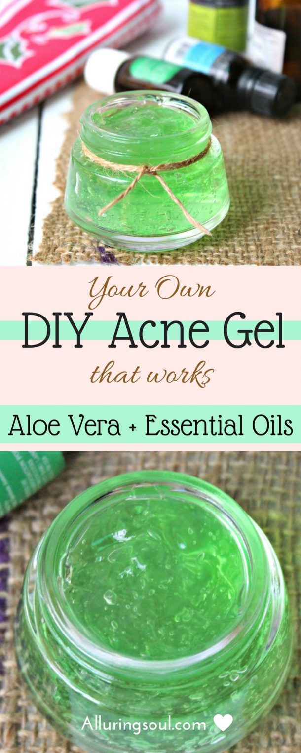 Your Own DIY Acne Gel That Works