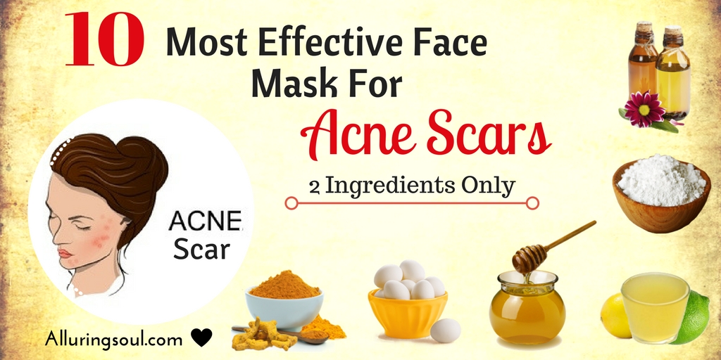 face mask for Acne Scar Alluring Soul