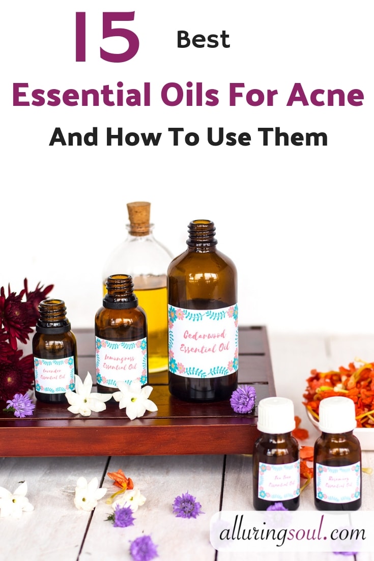 essential oil for acne