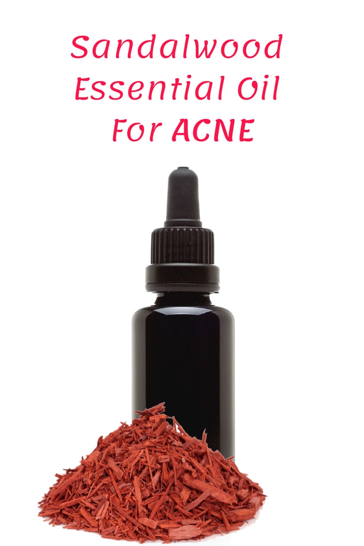 Essential Oil For Acne Alluring Soul