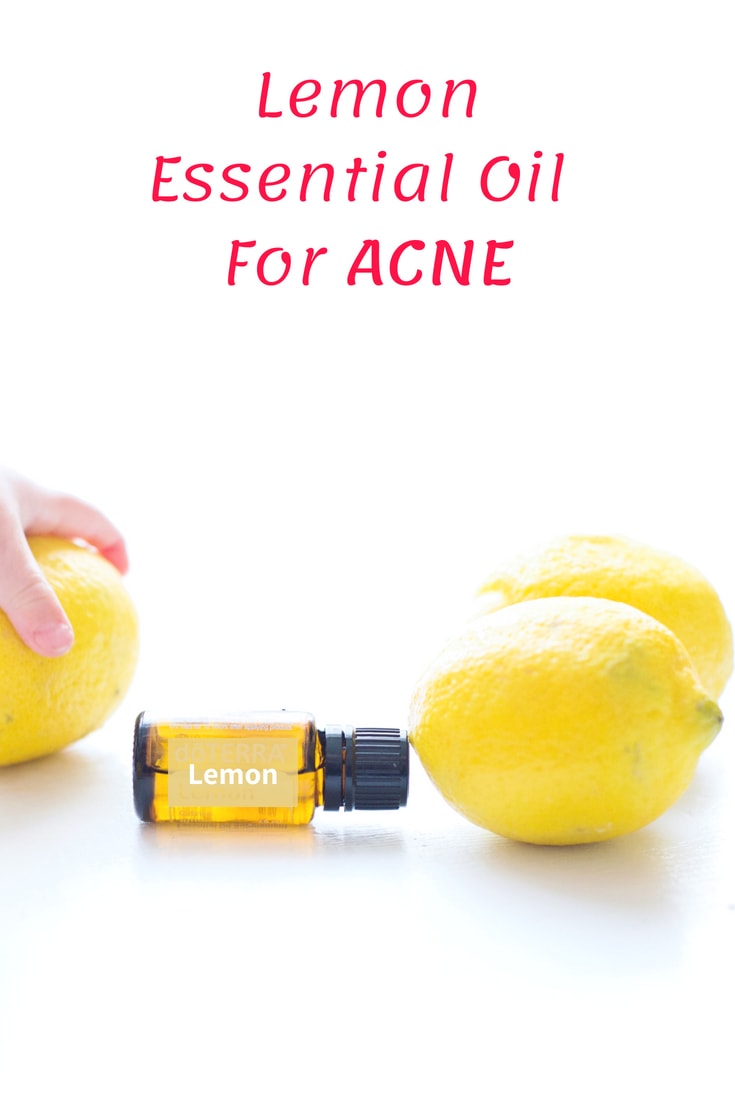 Essential Oil For Acne Alluring Soul