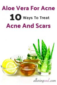 aloe vera for acne