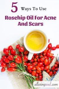 rosehip oil for acne